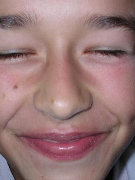 etienne